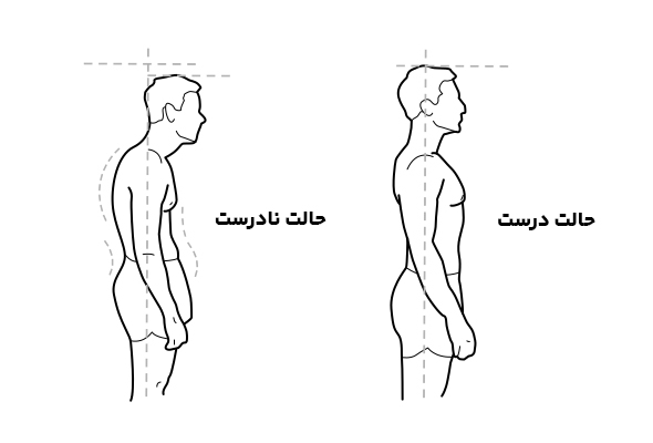 تاثیر کوهنوردی بر دیسک کمر (شاید برای شما هم اتفاق افتاده باشد) 10 آیا کوهنوردی برای دیسک کمر ضرر دارد